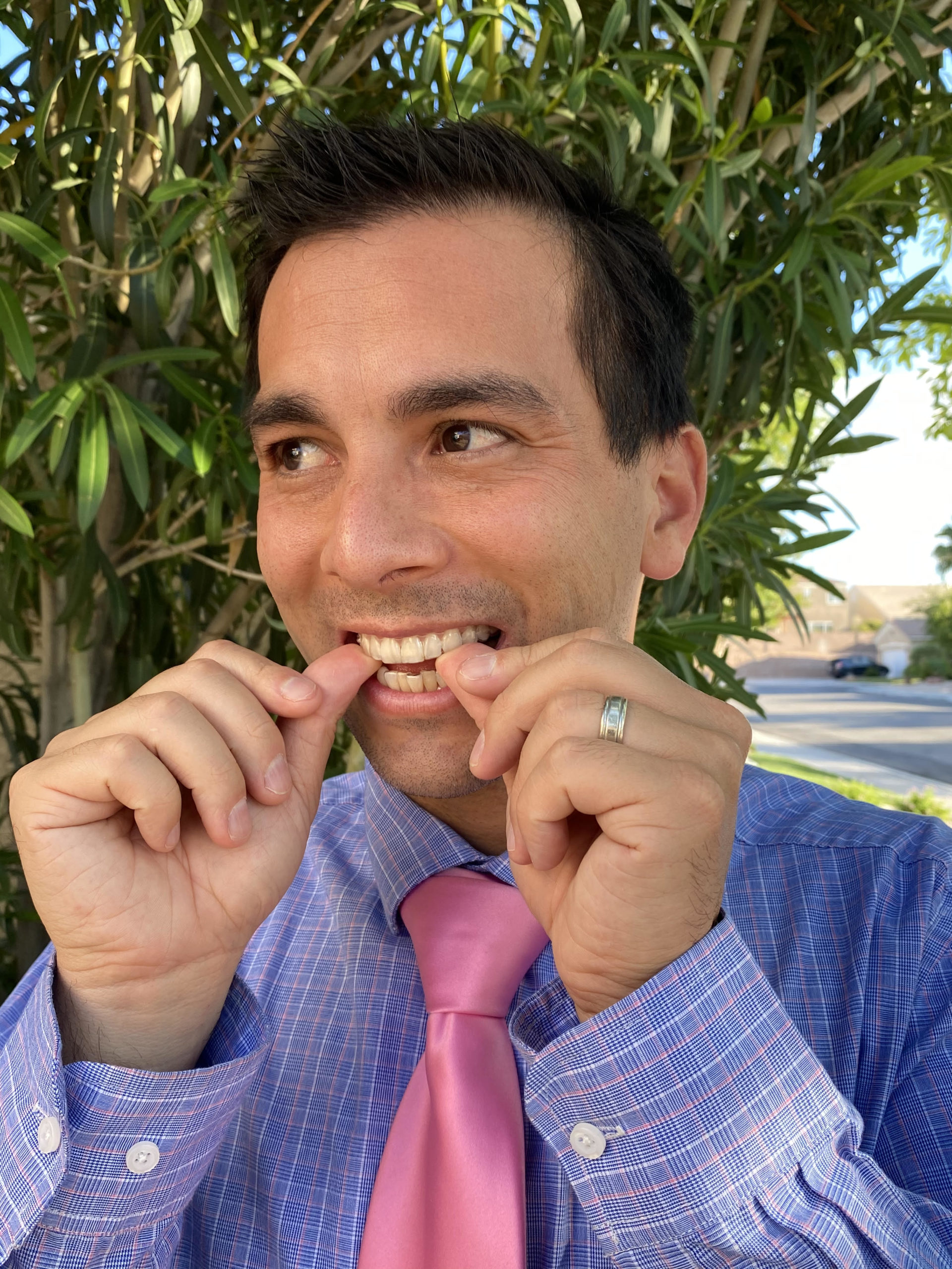 Okuda invisalign scaled