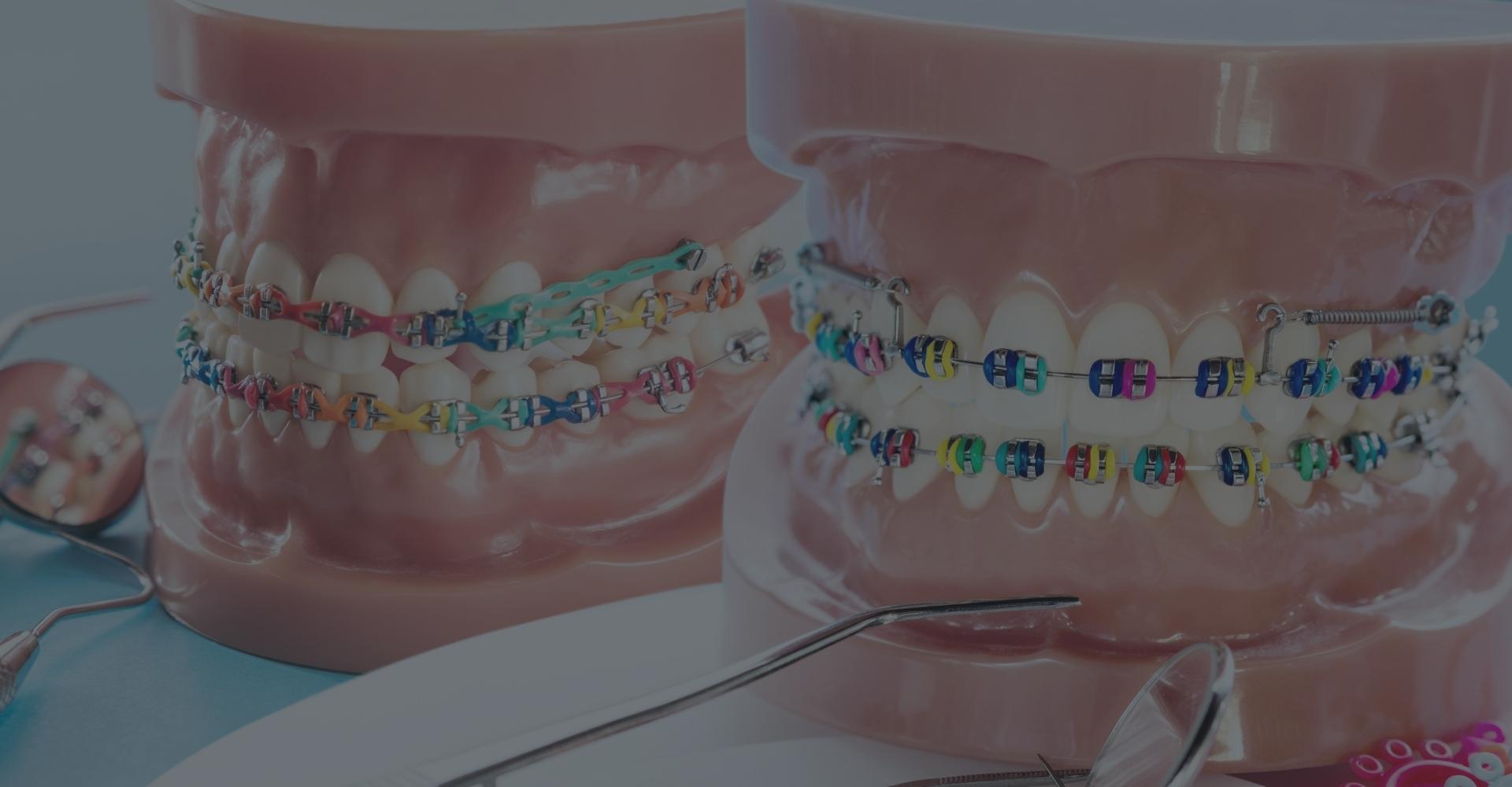 Okuda Orthodontics’ Guide to Navigating Life with Braces