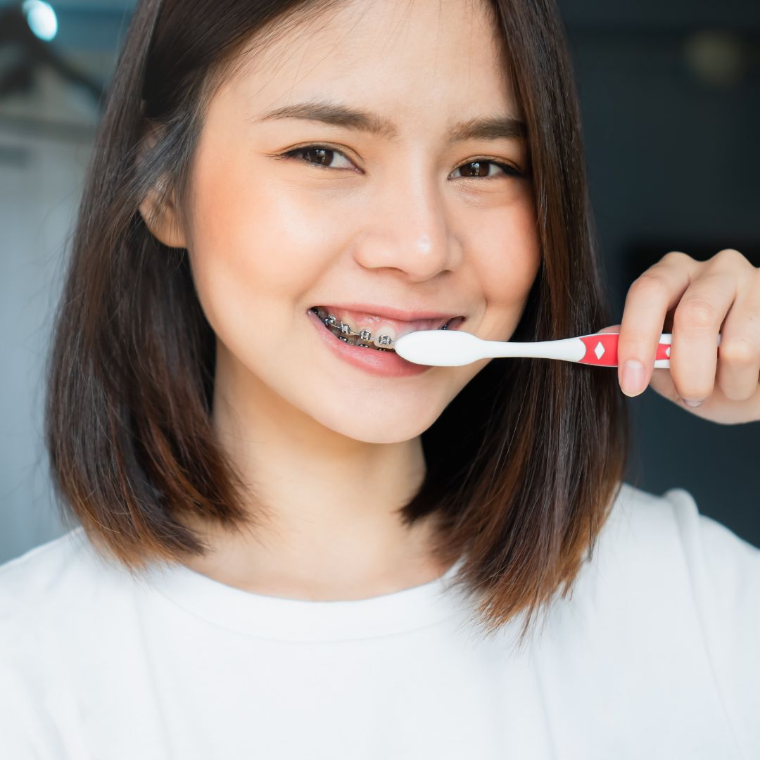 4 Benefits Of Getting Braces As A Kid | Okuda & Noorda Orthodontics