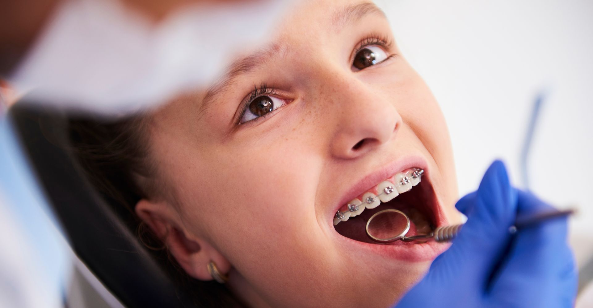 4 Benefits of Getting Braces as a Kid