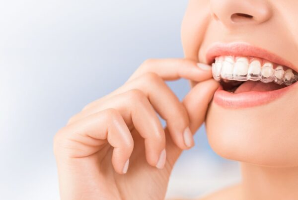 woman putting in Invisalign