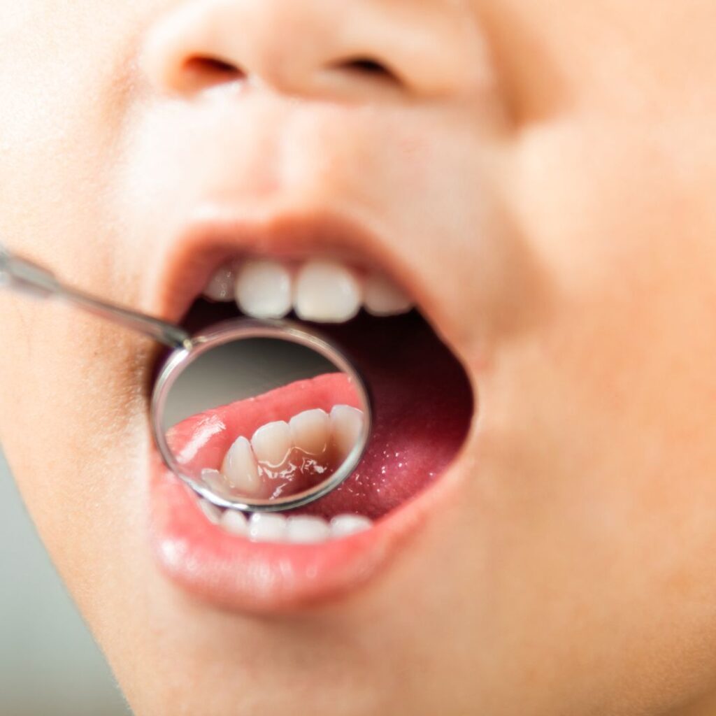 child's teeth
