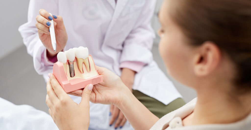 dental implants tooth