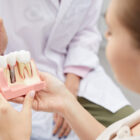 dental implants tooth