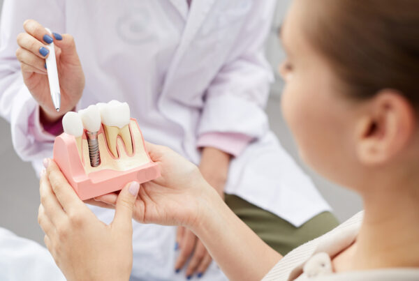 dental implants tooth