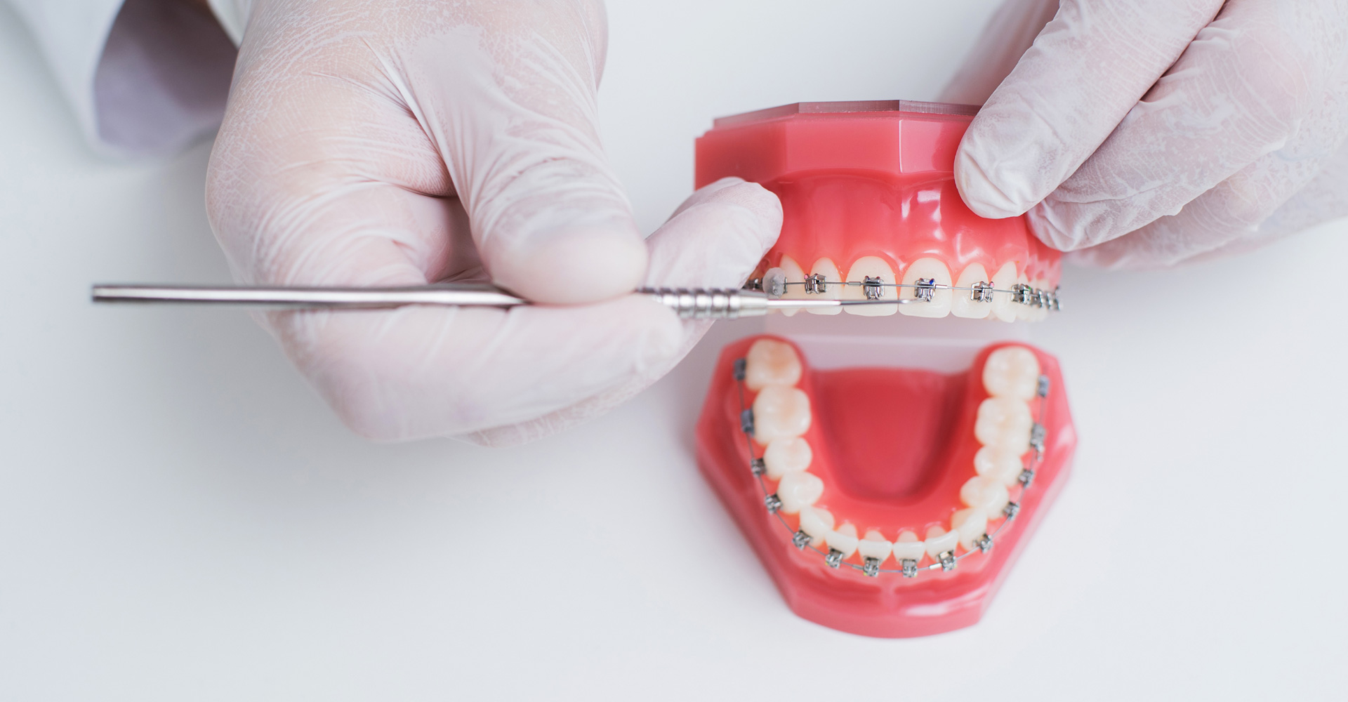 Planning Financially for Orthodontic Treatment