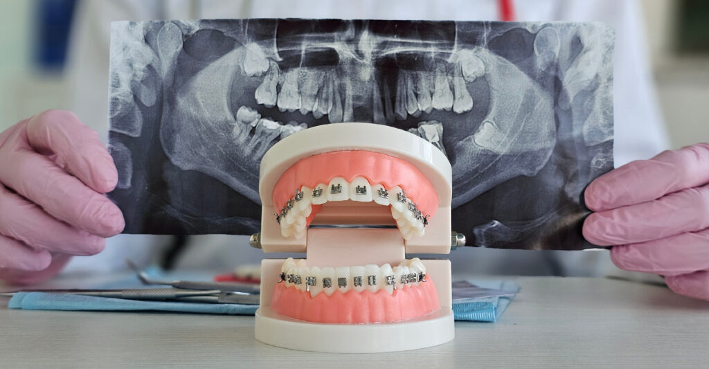 The Art of Smile Design: How Orthodontics Is Tailored to Facial Features 1 Orthodontist examining orthodontic model alongside dental X rays