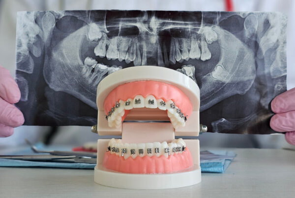 The Art of Smile Design: How Orthodontics Is Tailored to Facial Features 1 Orthodontist examining orthodontic model alongside dental X rays